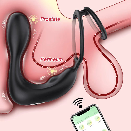 3-in-1 Remote Control Prostate Massager